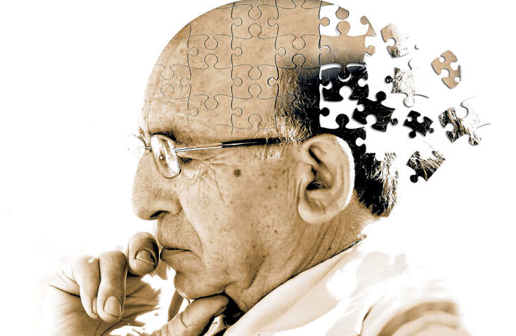 Alzheimer: 10 factores para diagnosticar la enfermedad en 5 minutos